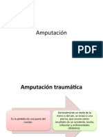 Amputación