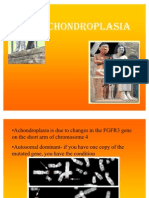 Achondroplasia