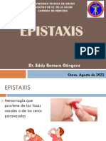 Epistaxis