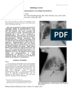 Hydropneumothorax Vs Simple Pneumothorax