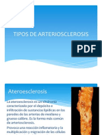 Tipos de Arteriosclerosis