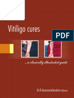 Vitiligo Cures Book