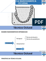 Técnica Oclusal