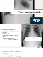 Tuberculos Pericarditis