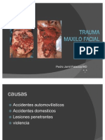 Trauma Maxilo Facial