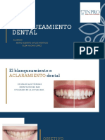 Blanqueamiento Dental 4