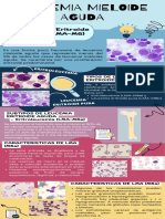 Equipo 8 (Hematopatologia) Leucemia Mieloide Aguda