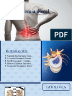 Hernia Discal