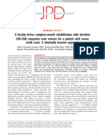 A Facially Driven Complete-Mouth Rehabilitation With Ultrathin CAD CAM Composite Resin Veneers For A Patient With Severe Tooth Wear A Minimally Invasive Approach