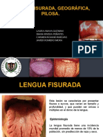 4.seminario, Lengua Fisurada