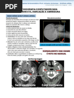 Guia Angiotomografia