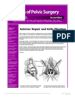 Anterior Repair and Kelly Plication