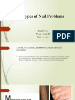 Types of Nail Problems Dec 13-17 WK 4 2nd QTR