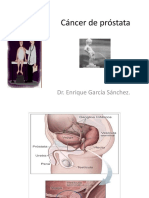 Cáncer de Próstata