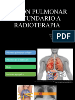 Copia de LESIONES PULMONARES INDUCIDAS POR RADIOTERAPIA