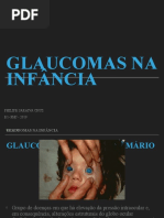 Glaucoma Congênito Infantil