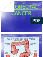 Colorectal Cancer