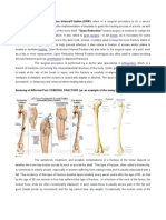 Open Surgery Bones Fractures: Description