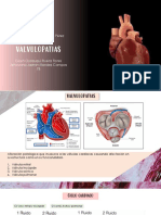 Valvulopatias
