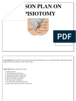 LP Episiotomy