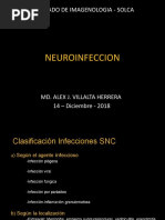 Neuroinfeccion