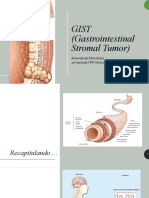 GIST (Gastrointestinal Stromal Tumor) Aula Slides