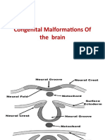 Congenital Malformations of The Brain