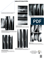 Remodelacion Fracturas Pediatricas Poster