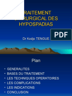 Hypospadias Tengue