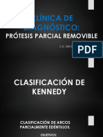 Diseño de Prótesis Parcial Removible  