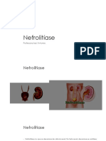 Nefrolitíase