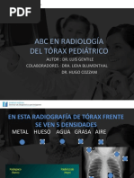 ABC RADIOLOGiA Torax pediatricoPPT