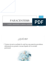 PARACENTESIS