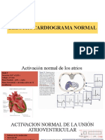 Ekg Normal