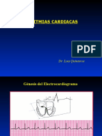 Arritmias Cardiacas