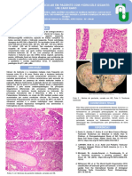 27 - Teratoma Testicular em Paciente Com Hidrocele Gigante Um Caso Raro