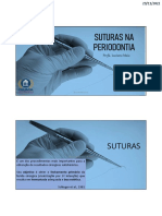 Aula Suturas Na Periodontia