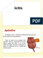 Apendicitis