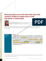 Ultrasound Guided Access of The Distal Radial Artery at The Anatomical Snuffbox