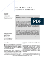 Effect of Acid On Teeth and Its Relevance in Postm