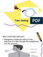 Tube Feeding