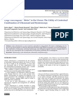 Large Anechogenic "Holes" in The Uterus: The Utility of Contextual Combination of Ultrasound and Hysteros