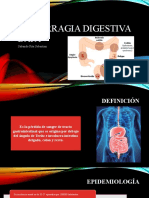 Hemorragia Digestiva Baja