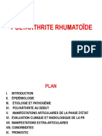 Polyarthrite Rhumatoide