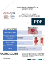 Gastrosquisis Onfalocele