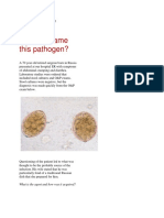 Case History No6 DiPersio Diphyllobothrium Jan 2012