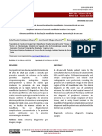 Osteoma Periférico de Inusual Localización Mandibular