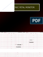 Electronic Fetal Monitoring