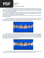 Curso - Facetas em Resinas Compostas - Felipe Bezerra