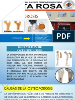 Osteoporosis Grupo N°